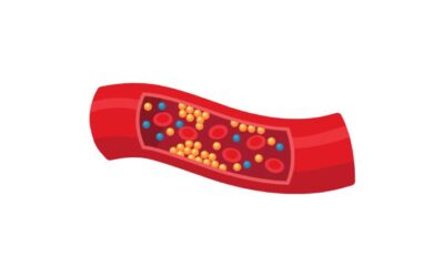 Cholesterol in our Body