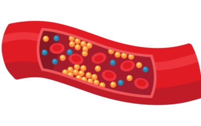 Blood Clots in Blood vessels
