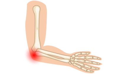 Elbow Joint Pain – Causes and Management