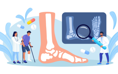 Heel pain – Can’t get out of Bed – Plantar Fasciitis