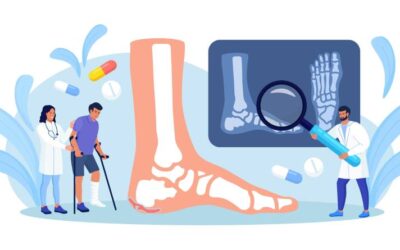 Heel Spur – Symptoms and Treatment