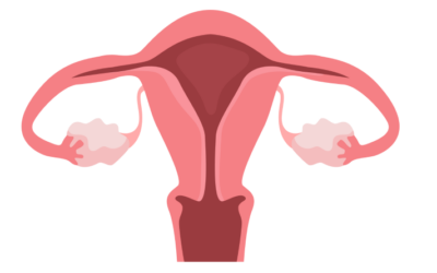What is Hysterectomy?